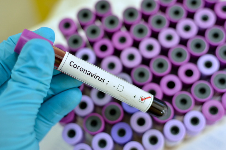 A Giulianova si registra il primo caso di Coronavirus. Il Sindaco:”  L’uomo era già in quarantena”